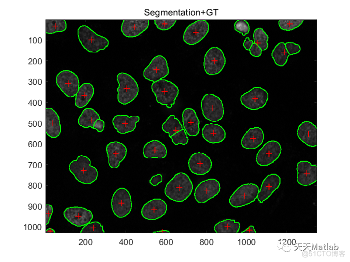 【图像分割】基于区域的重叠椭圆拟合实现细胞分割附matlab代码_拟合