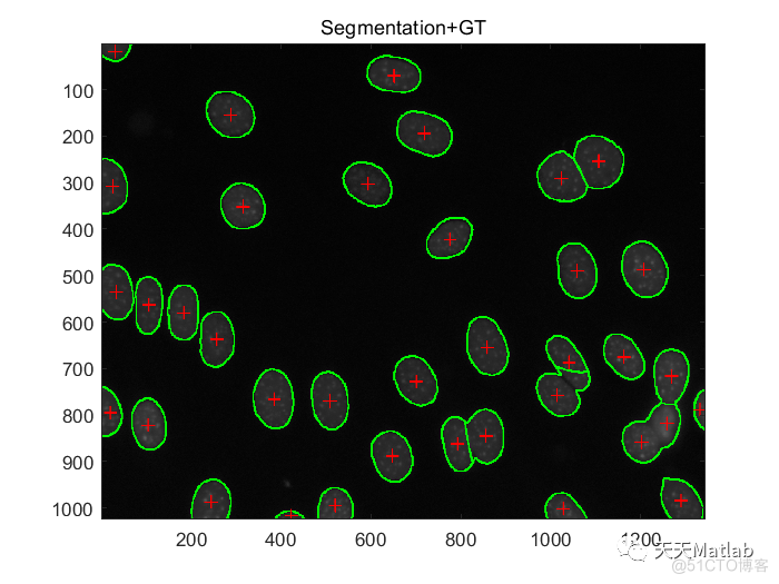 【图像分割】基于区域的重叠椭圆拟合实现细胞分割附matlab代码_图像分割_02